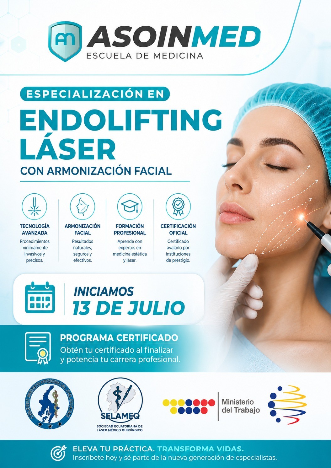 Endolifting